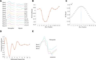 Frontiers | Muscle Innervation Zone Estimation From Monopolar High ...